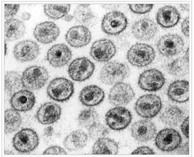 HIV